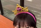 치과 가기 전후의 딸 반응