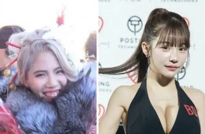 8410.jpg 2억원치 성형결과