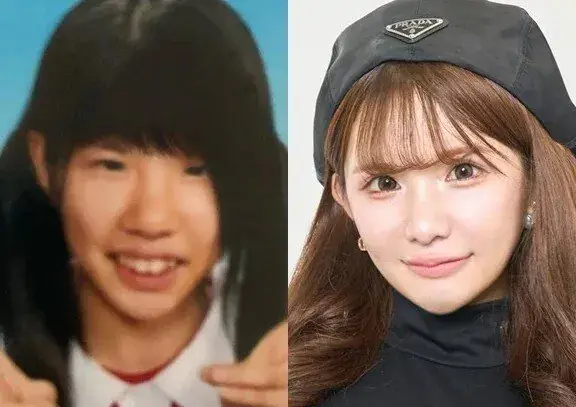 8413.jpg 2억원치 성형결과