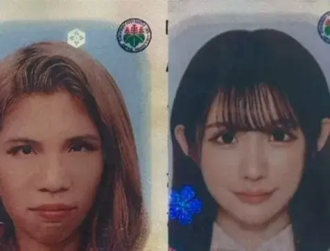 8414.jpg 2억원치 성형결과