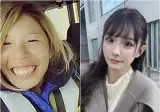2억원치 성형결과