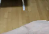30년 넘게 아무렇지 않게 살아왔는데 팔에 점 때문에