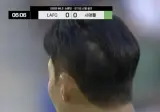 손흥민 '원형 탈모 의심'