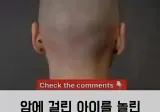 암에 걸린 아이를 놀린 딸의 머리를 밀어버린 아빠
