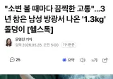 3년 참은 남성 방광서 나온 '1.3kg' 돌덩이 ㄷㄷㄷ