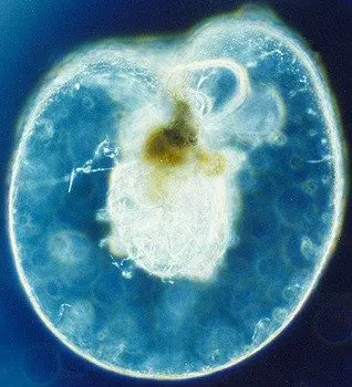 Noctiluca_scintillans_unica.jpg