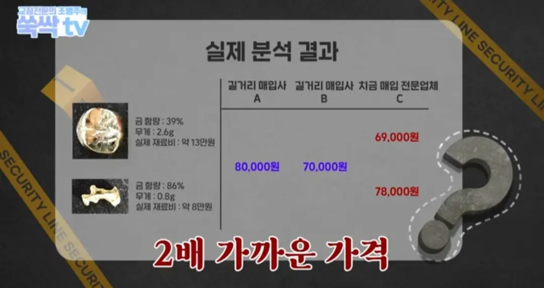 image.png 치과 치료후 나온 금이빨을 길거리 매입업체에 팔면 안되는 이유