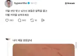 팔뚝을 물고 이빨 자국을 보여주세요.jpg