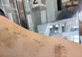 혐주의) 투석개붕이 팔상태