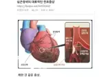 심근경색의 대표적인 전조증상.jpg
