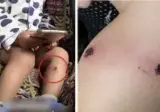 이스라엘이 나치를 뛰어넘었다고 생각한 사건중 하나