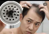 잦은 자위행위, 탈모 위험 75% 높인다