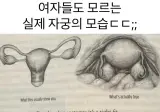 여자들도 모르는 실제 자궁 모습