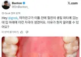 여자친구의 입안 속 자국이 생겼어요. 이유가 뭔지 알려줄 수 있어요?