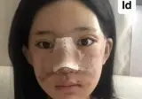 여자 성형수술 레전드