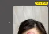 머리에 부황뜬 딸이 한심했던 어머니