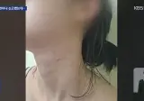 3번이나 신고했는데 감금·흉기 협박 스토킹범 놔준 경찰