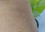 더러움 주의) 뽐게 사마귀 제거기 떴길래 제 발바닥 봤는데..
