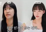 양악수술 전후 여자 외모 변화