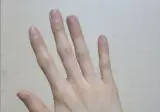 의외로 노화가 가장 빠른 신체부위