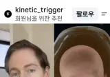 자신을 복제해 장기 교체