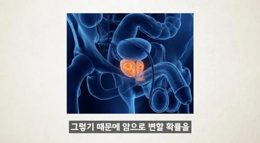 image.png 한달에 21번 사정해라
