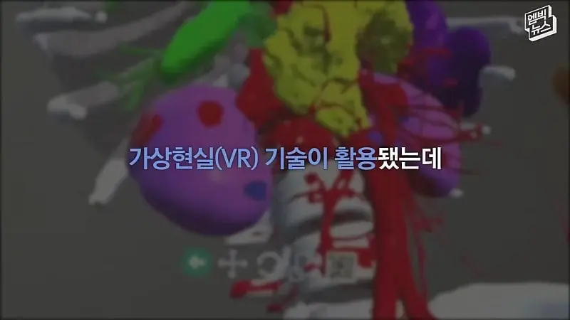 33시간 수술 끝에 얼굴 본 쌍둥이.jpg