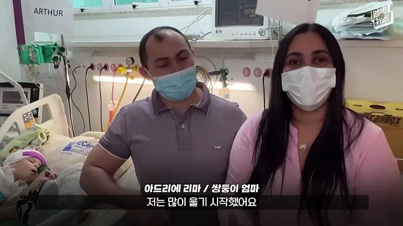 33시간 수술 끝에 얼굴 본 쌍둥이.jpg
