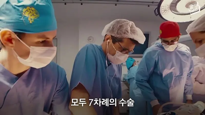 33시간 수술 끝에 얼굴 본 쌍둥이.jpg