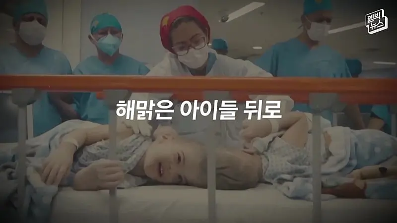 33시간 수술 끝에 얼굴 본 쌍둥이.jpg