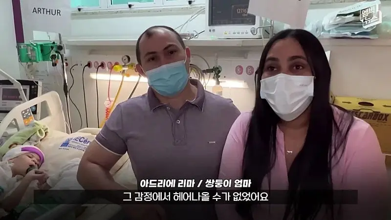 33시간 수술 끝에 얼굴 본 쌍둥이.jpg