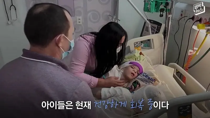 33시간 수술 끝에 얼굴 본 쌍둥이.jpg