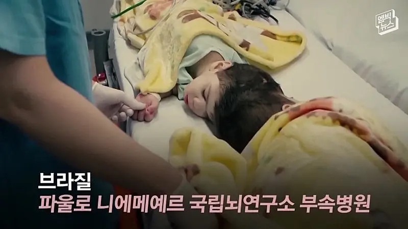 33시간 수술 끝에 얼굴 본 쌍둥이.jpg
