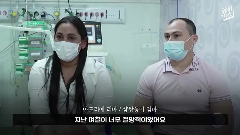 33시간 수술 끝에 얼굴 본 쌍둥이.jpg