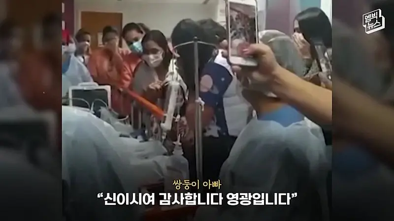 33시간 수술 끝에 얼굴 본 쌍둥이.jpg