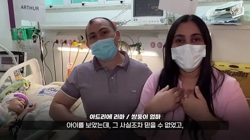 33시간 수술 끝에 얼굴 본 쌍둥이.jpg