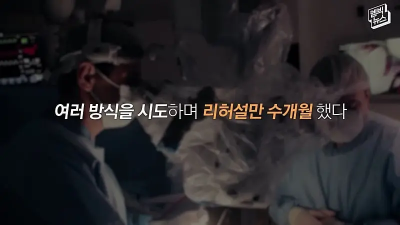 33시간 수술 끝에 얼굴 본 쌍둥이.jpg