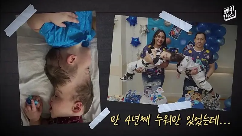 33시간 수술 끝에 얼굴 본 쌍둥이.jpg