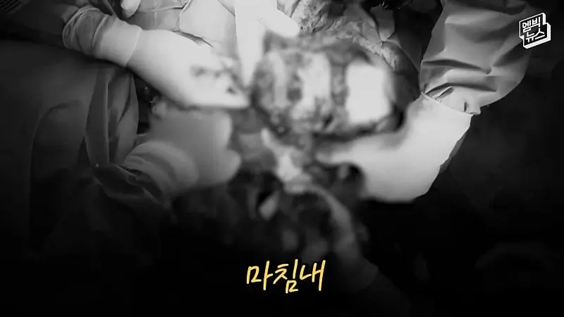 33시간 수술 끝에 얼굴 본 쌍둥이.jpg