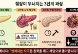 췌장이 무너지는 3단계 과정