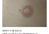 병원에서 주사를 맞았는데.jpg