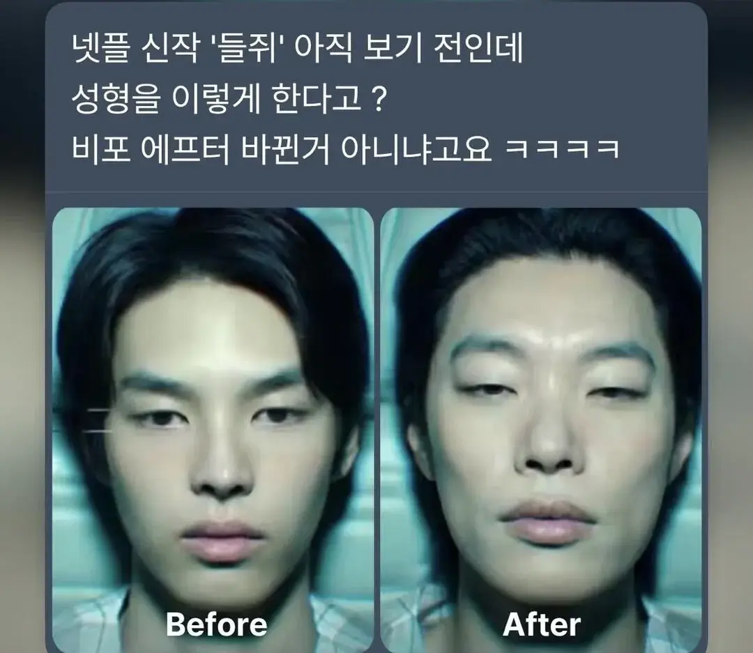 1000007721.jpg 어딘가 이상한 성형 전후
