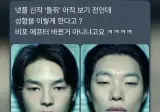 어딘가 이상한 성형 전후