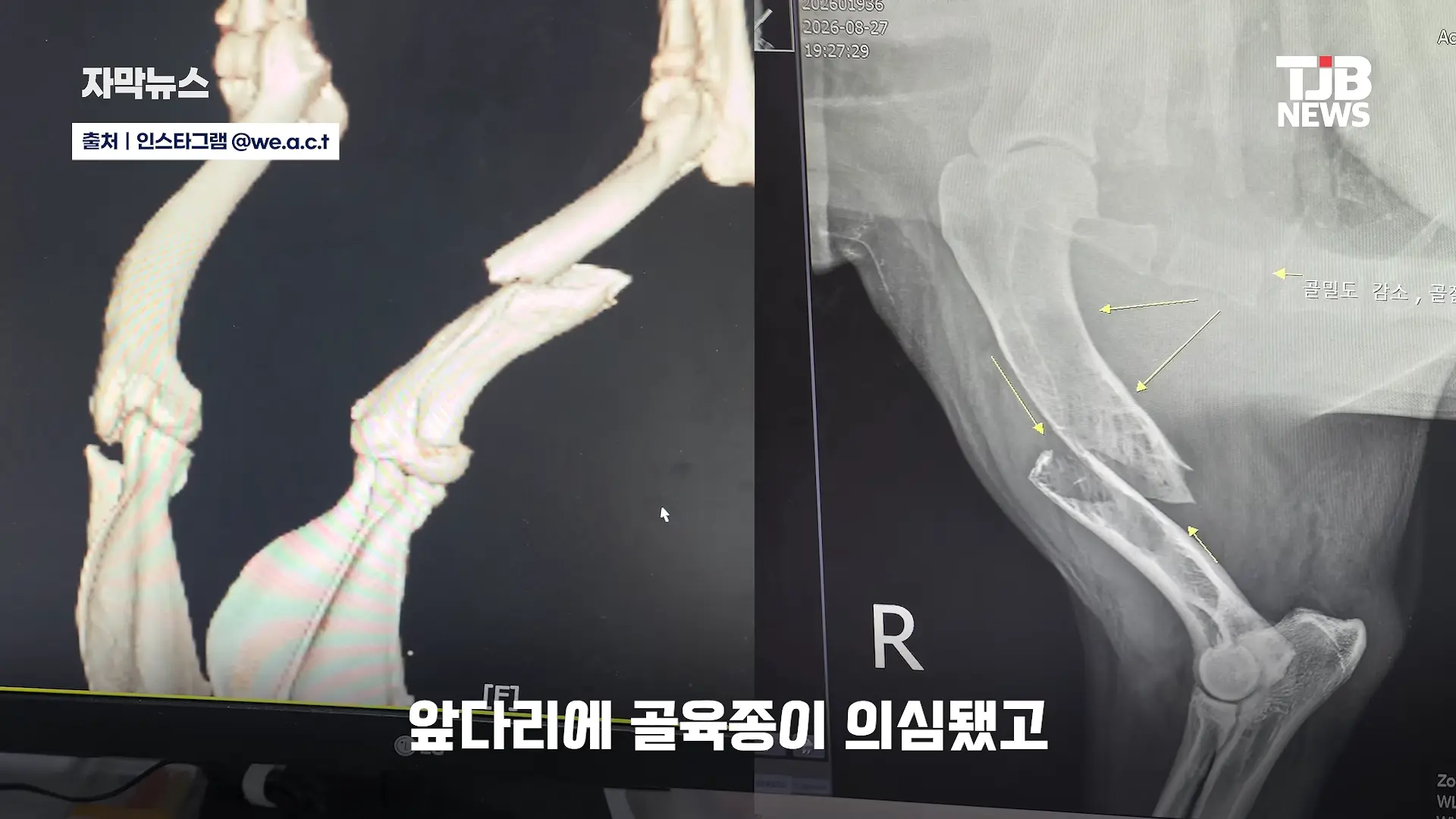 부러진 다리로 8시간 견뎌. 수로에 갇혔던 리트리버 근황｜ TJB 대전·세종·충남뉴스 00-00-31.png