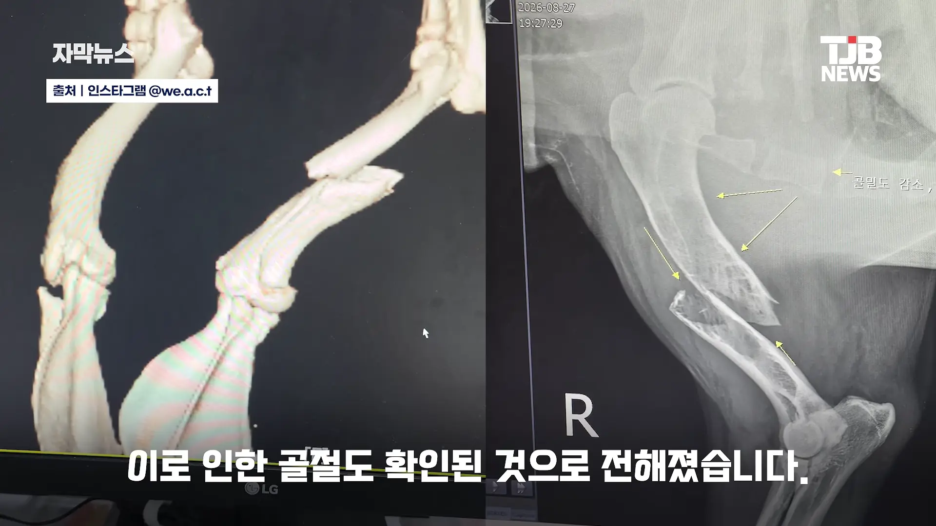부러진 다리로 8시간 견뎌. 수로에 갇혔던 리트리버 근황｜ TJB 대전·세종·충남뉴스 00-00-33.png
