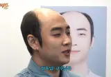 ai 사진 아니냐고 의심 받았다는 올해 41살인데 탈모 심한 남자