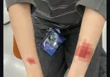 일본서 반응 좋은 반창고