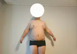 고도비만은 그냥 위고비 마운자로 맞아라