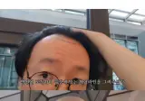 터키로 모발이식 받으러간 남자의 최후.jpg