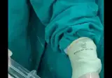 결석 제거 시술